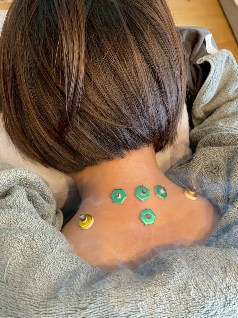 閑閑堂_お灸施術