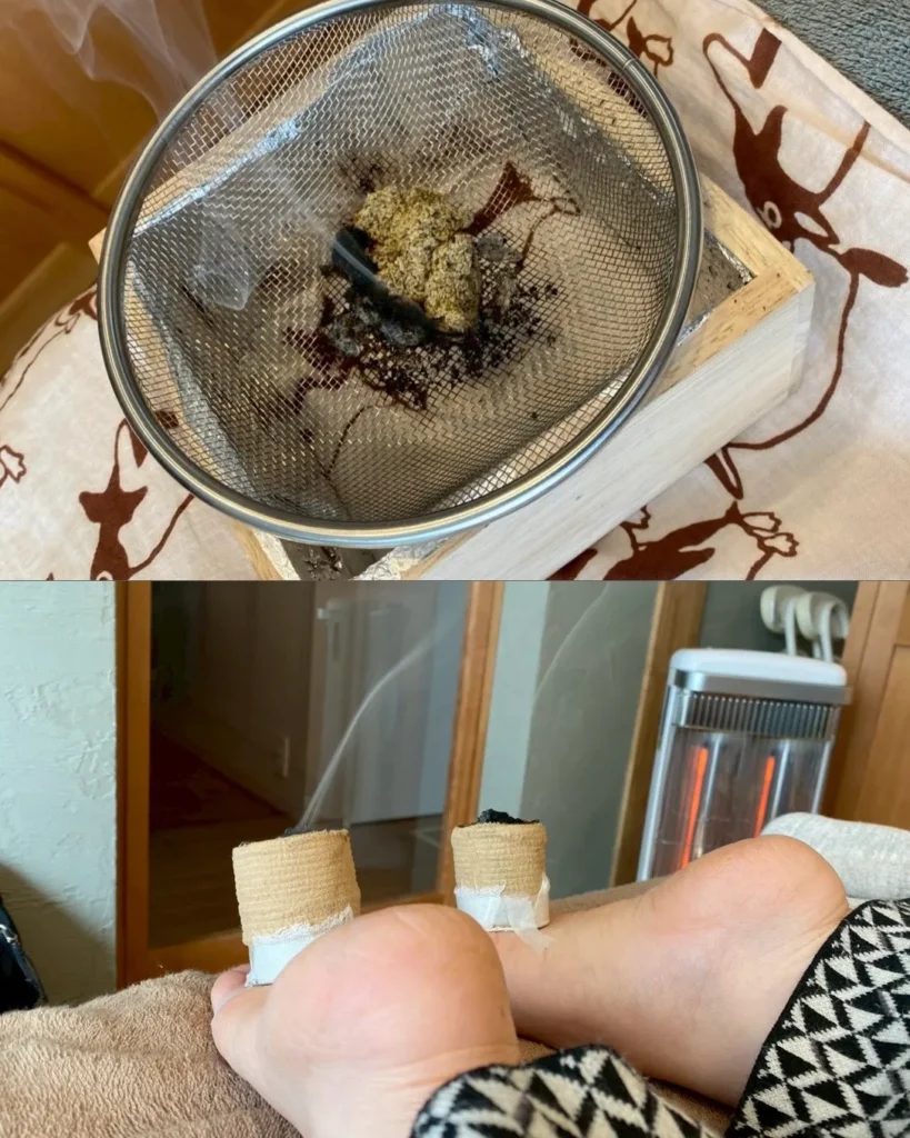 閑閑堂_お灸施術_コラージュ